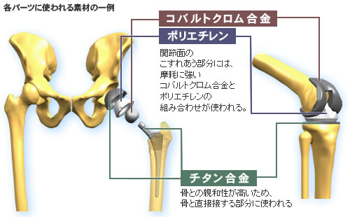 各パーツに使われる素材の一例