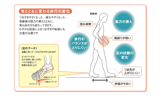 年とともに変わる歩行の変化