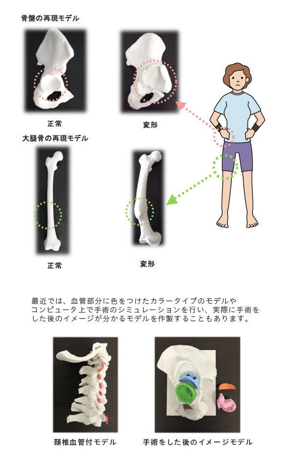 骨盤の再現モデル