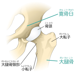 股関節の構造 股関節のしくみ 股関節の痛み 関節の痛み 人工関節ドットコム
