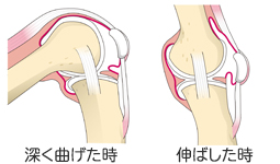 ひざ関節の構造 ひざ関節のしくみ ひざ関節の痛み 関節の痛み 人工関節ドットコム