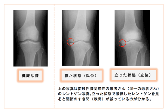 レントゲン写真１