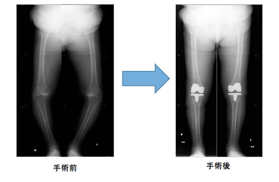 手術前・後