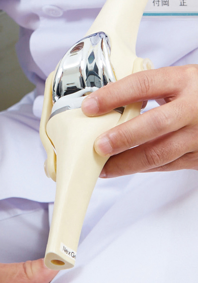 人工膝関節の一例