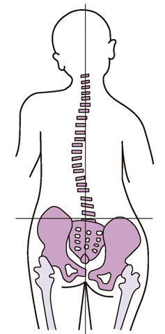 股関節や腰、背骨の痛みはそれぞれが関係していることがあります