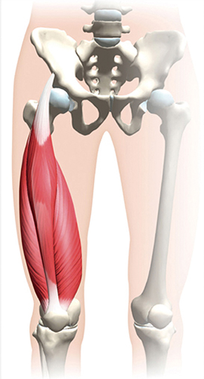 大腿四頭筋