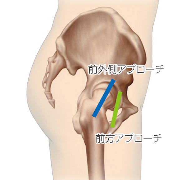 イメージイラスト