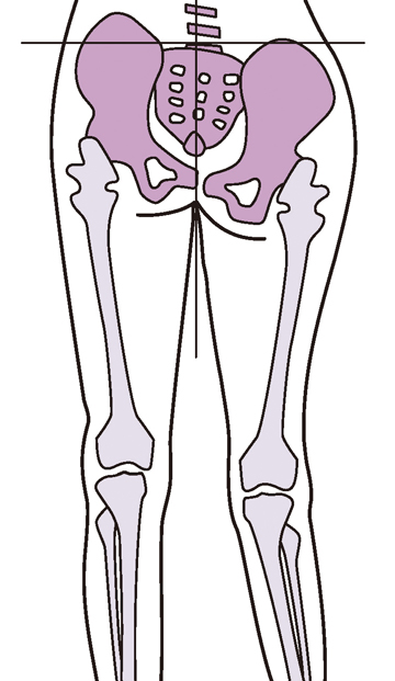 股関節と膝関節の不安定性
