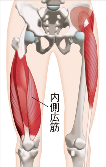 内側広筋