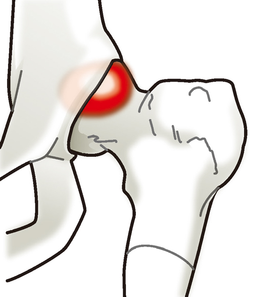 富沢 一生 先生 股関節や膝の痛みの原因や治療法にはどのようなものがありますか 股関節や膝の痛みの原因は様々 専門医に早目に相談し自分の状態を正しく認識しましょう 人工関節ドットコム