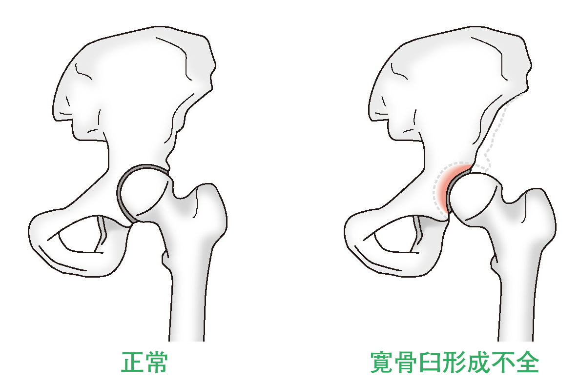 股関節のイラスト