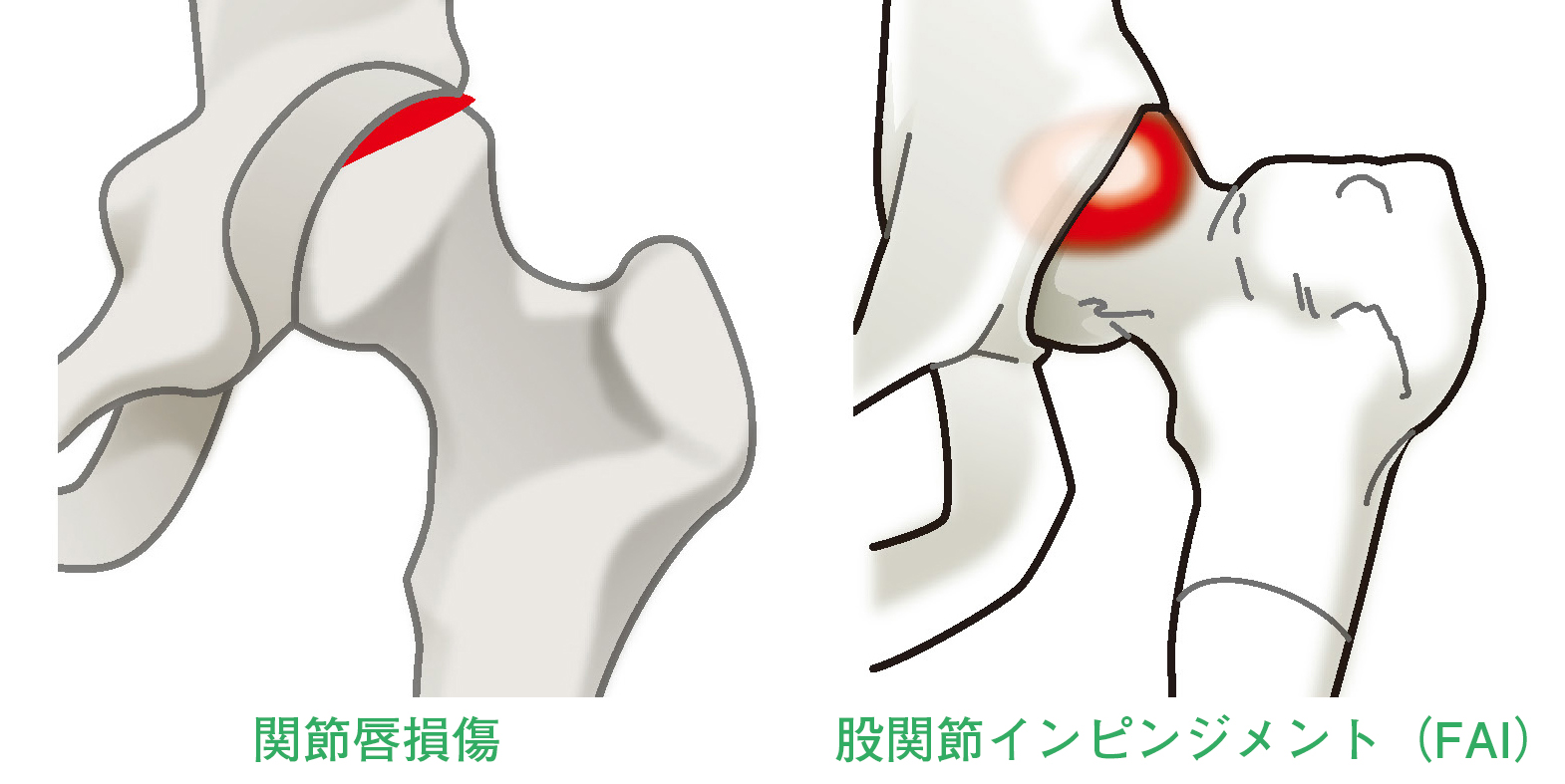 股関節のイラスト