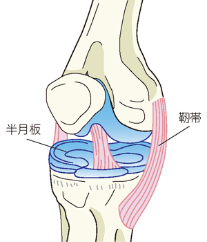 変形性膝関節症（両膝）のレントゲン