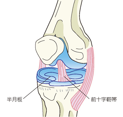 半月板と前十字靭帯損傷