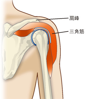 肩峰と三角筋