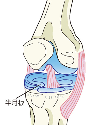 半月板