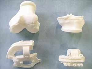 3Dプリンターで患者さん個々のひざの骨模型を作成