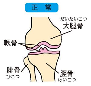 正常な膝関節