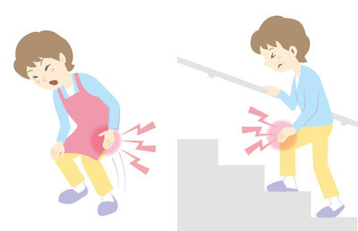 痛みが出てきたら早めに専門医に相談しましょう