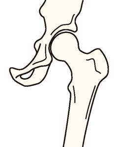 正常な股関節