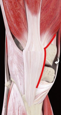 Subvastus アプローチ