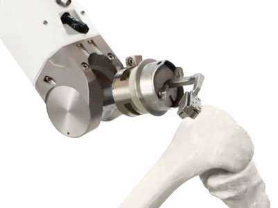 関節包靭帯支援ロボットのイメージ