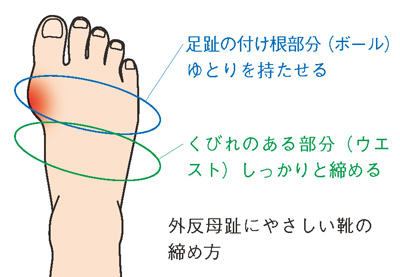 外反母趾にやさしい靴の締め方