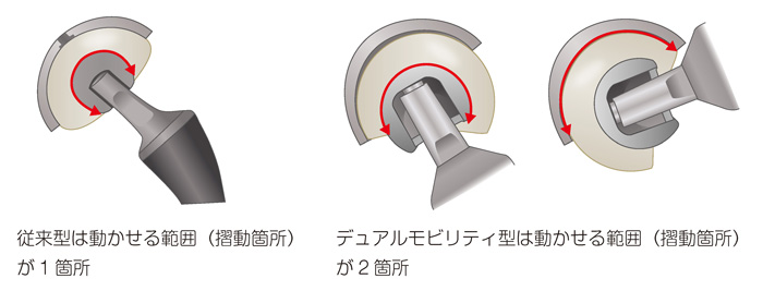 従来型とデュアルモビリティ型