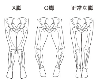 X-O-正脚